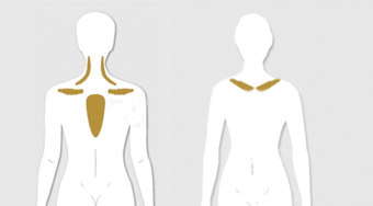 Braunes-Fett_Verteilung-am-Oberkoerper