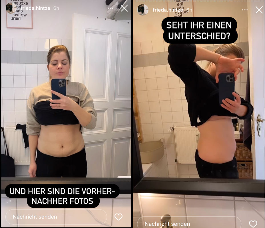 Frieda-Hintze-testet-Slimcool mit Erfolg-vorher-nachher